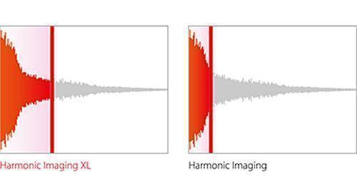 Công nghệ Harmonic Imaging XL Kawai CA 9500 GP